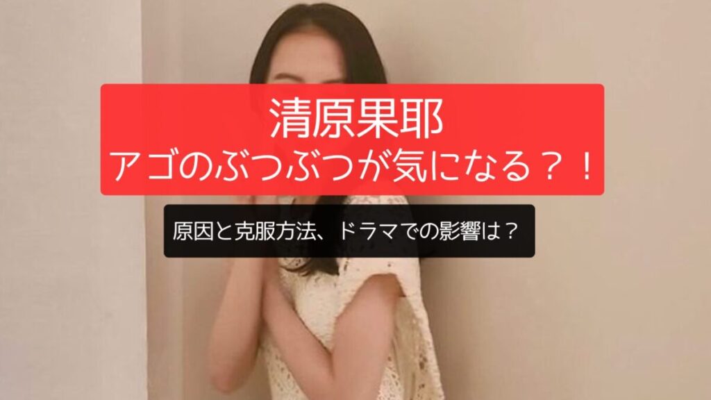 清原果耶のアゴのぶつぶつが気になる？！原因と克服方法、ドラマでの影響は？