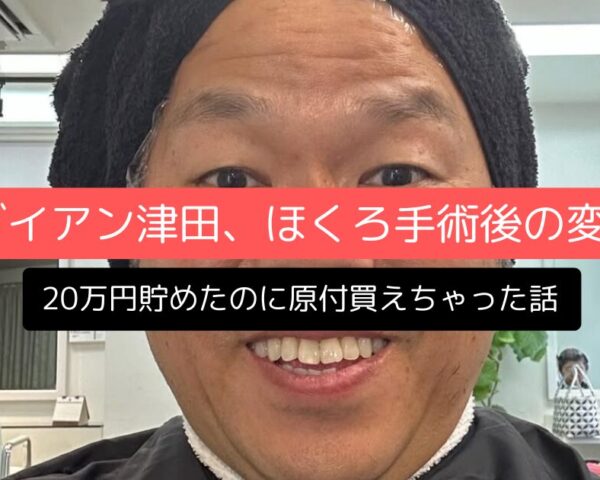 ダイアン津田、2,000円のほくろ手術後の変化～20万円貯めたのに原付買えちゃった話～