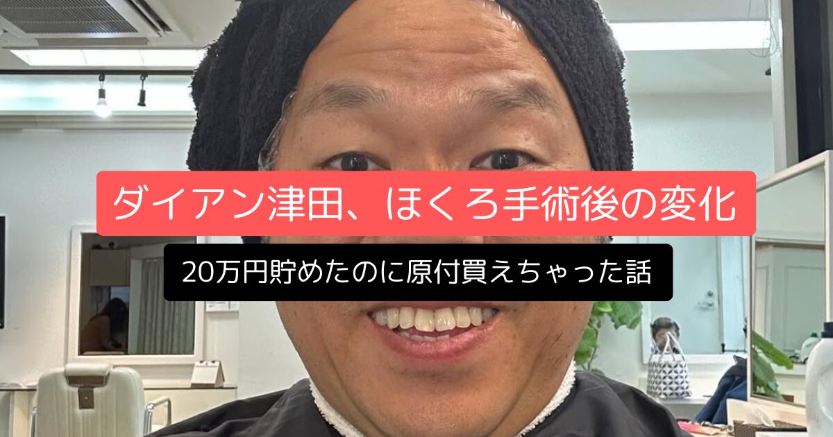 ダイアン津田、2,000円のほくろ手術後の変化～20万円貯めたのに原付買えちゃった話～