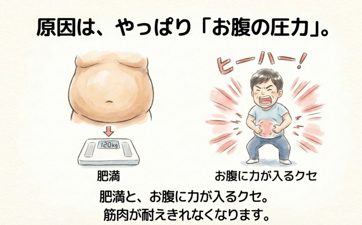 なぜ臍ヘルニアに？ 原因はやっぱり肥満？