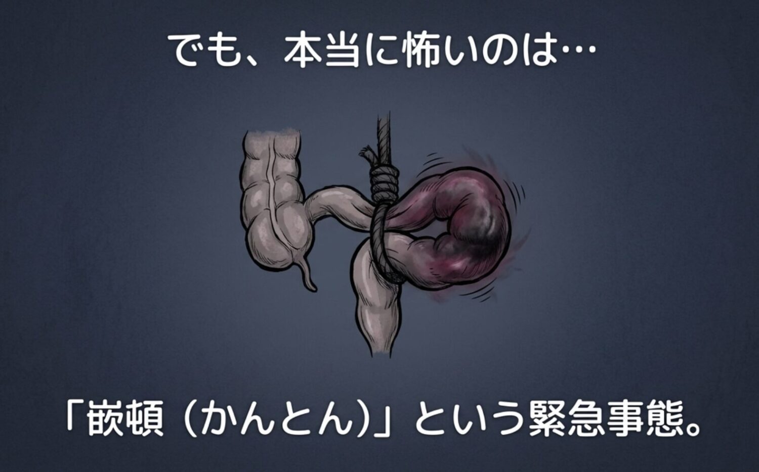 放置するとヤバい？ 「嵌頓（かんとん）」