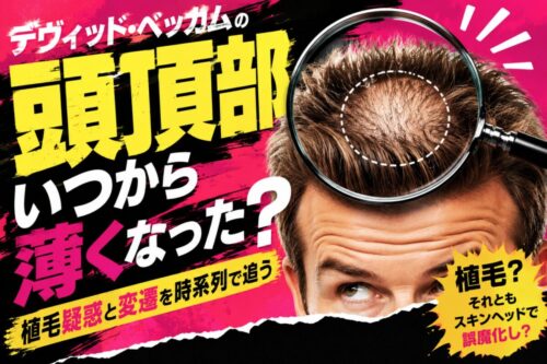 デヴィッド・ベッカムの頭頂部はいつから薄くなった？植毛疑惑と変遷を時系列で追う