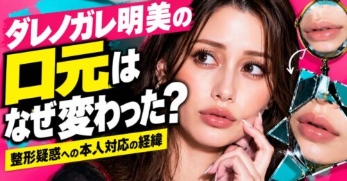 ダレノガレ明美の口元はなぜ変わった？整形疑惑への本人対応の経緯