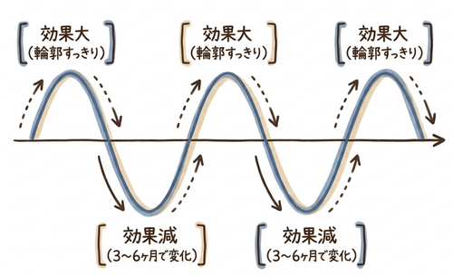 ボトックスの効果持続期間